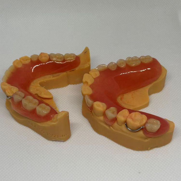 Dental Removable Partial Denture With Wire Clasp