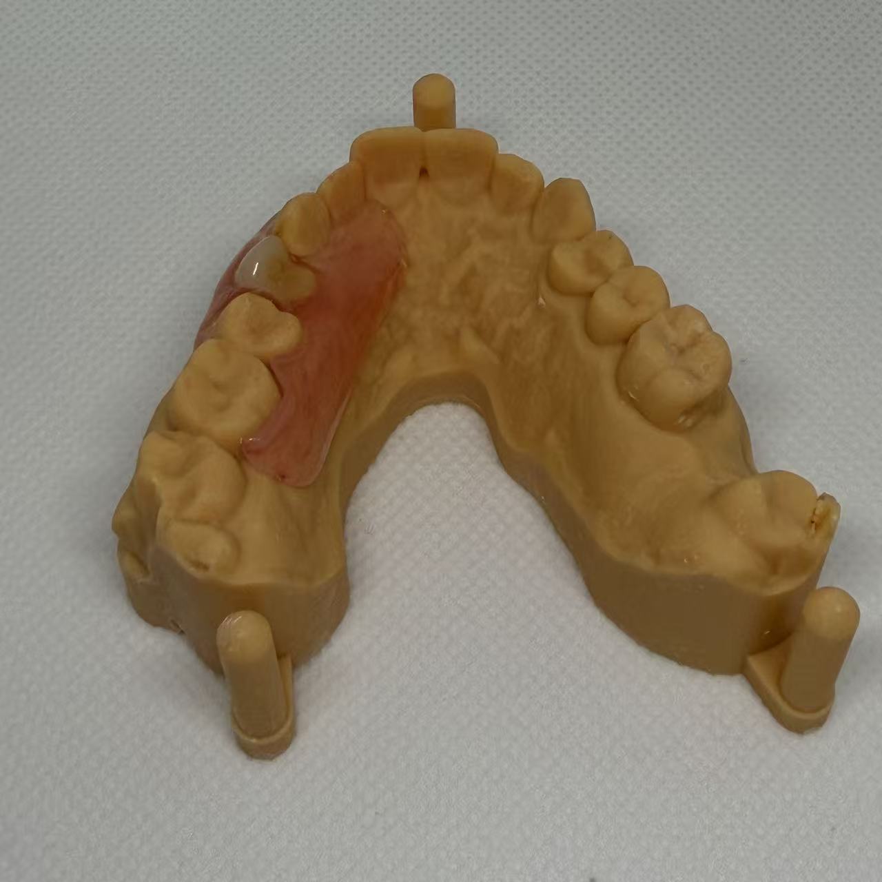single-sided flexible denture