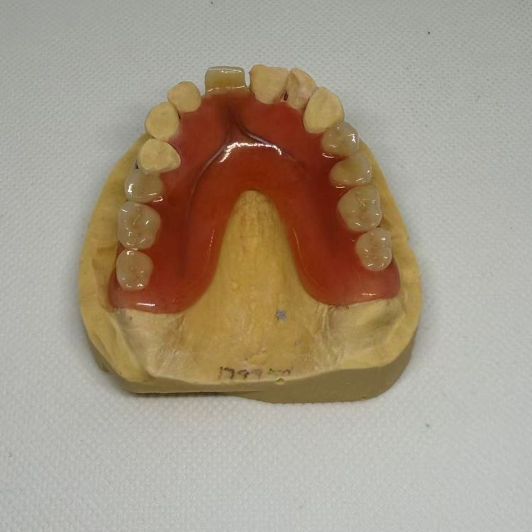 Dental Removable Acrylic Partial Denture